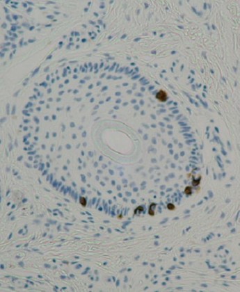 Figure 5 - Merkel Cells